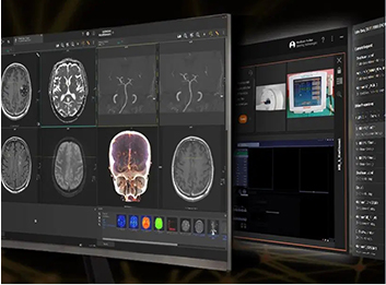 How new Google Nex···